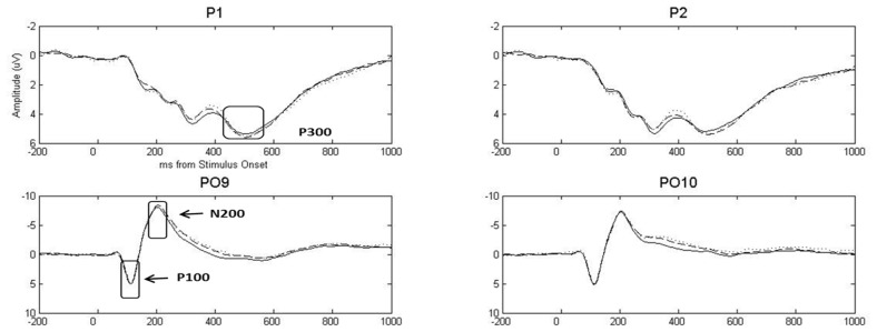 FIGURE 1