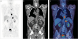 Fig 3.