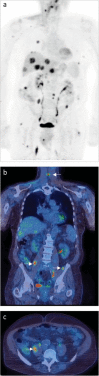 Fig 4.