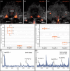 Differences in expression levels of the three pdf genes and MALDI-TOF mass spectra of the three PDFs in H. exemplaris.