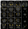 Localization of each of the three PDFs in the nervous system of H. exemplaris.