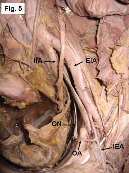 Figure 5