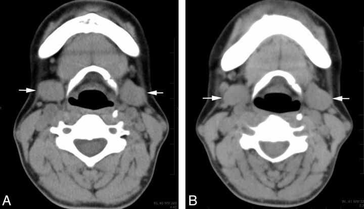 Fig 4.