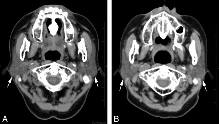 Fig 1.