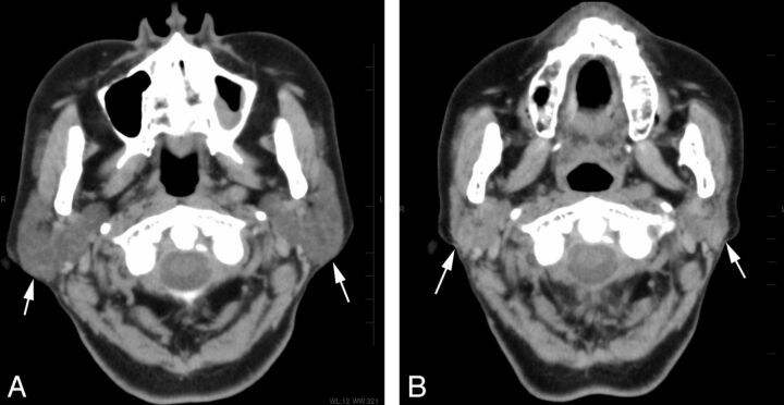 Fig 2.