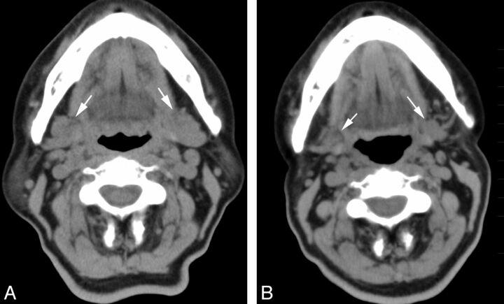 Fig 5.