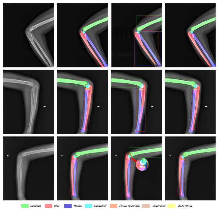 Figure 11
