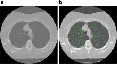 Fig. 9