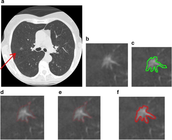 Fig. 13