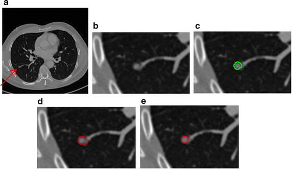 Fig. 14