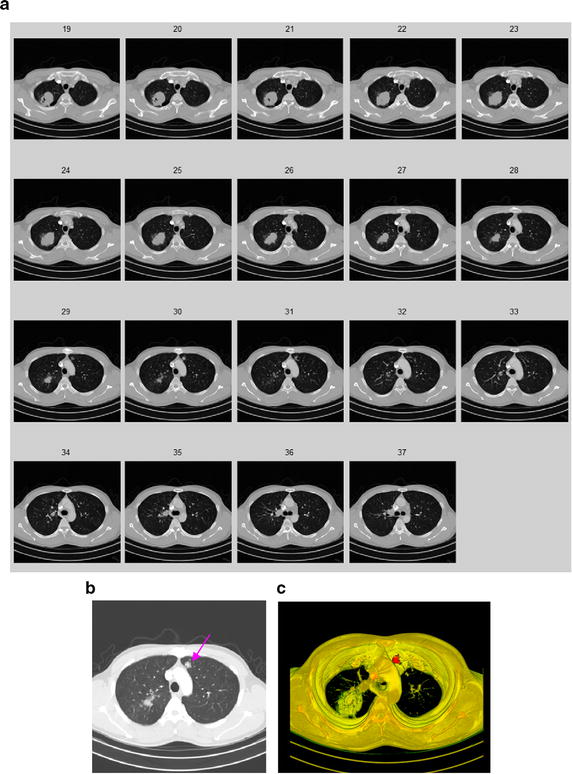 Fig. 17