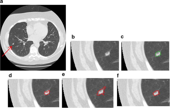 Fig. 16