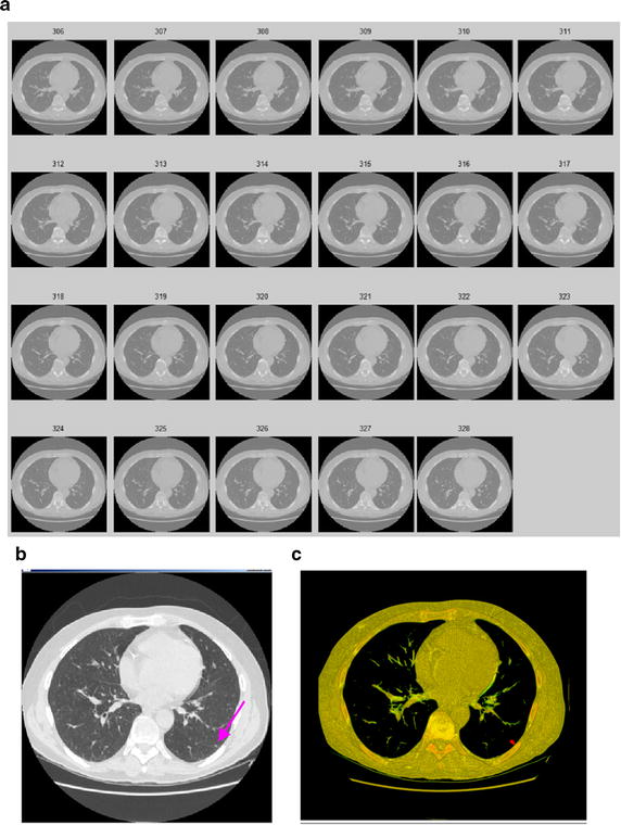 Fig. 18