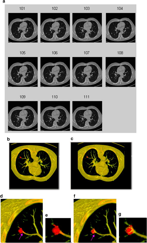 Fig. 15