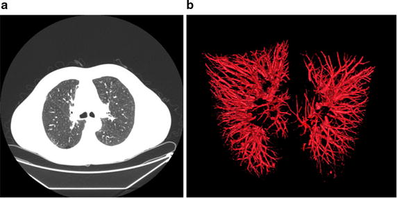 Fig. 11