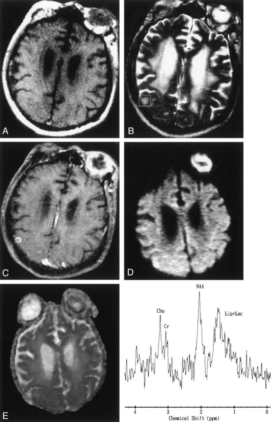 Fig 1.