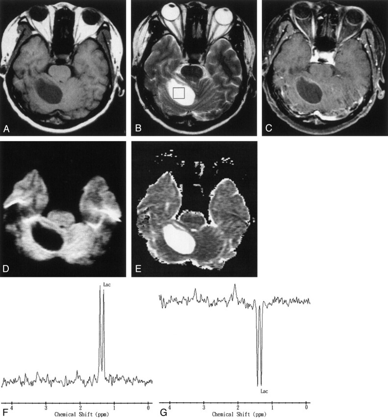 Fig 4.