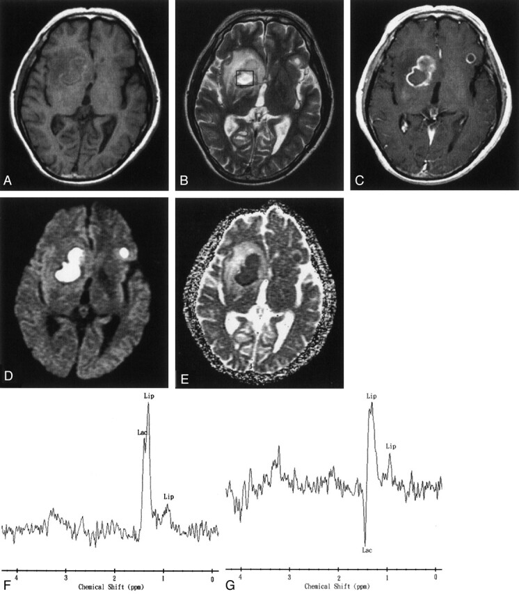 Fig 3.