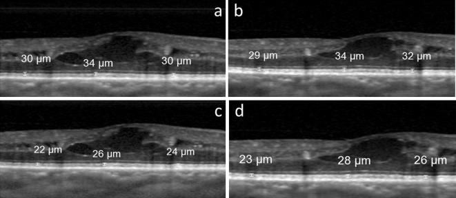 Fig. 2