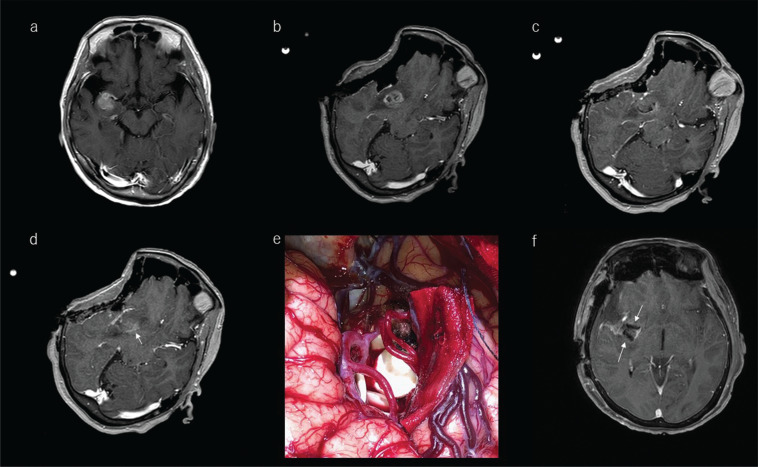 Fig. 10