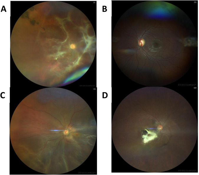 Fig. 1