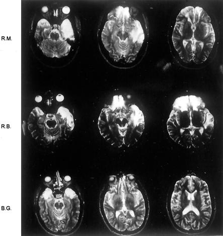 Fig 2.