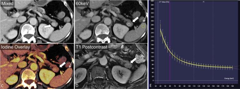 Figure 12.