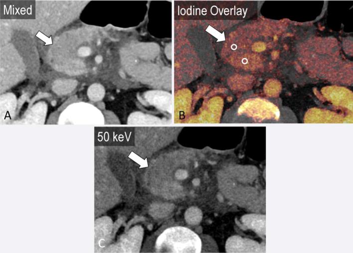 Figure 13.