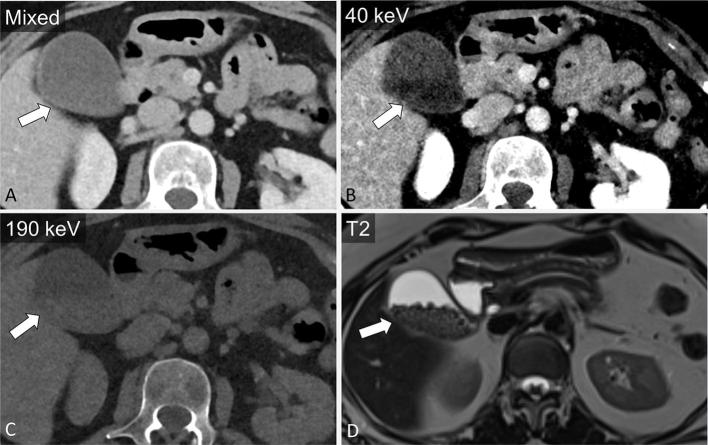 Figure 15.