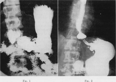 Fig. 1., Fig. 2.