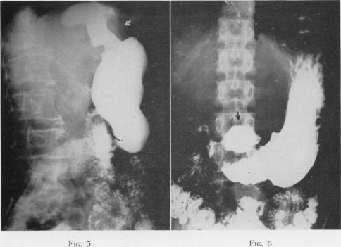 Fig. 5., Fig. 6.