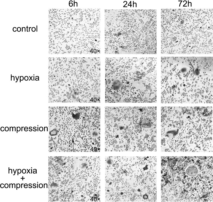 Figure 4. TRAP staining of the coculture systems after a 10-day culture with conditioned media from PDLCs subjected to hypoxia and/or compression in a period of 6, 24, and 72 hours (×40).