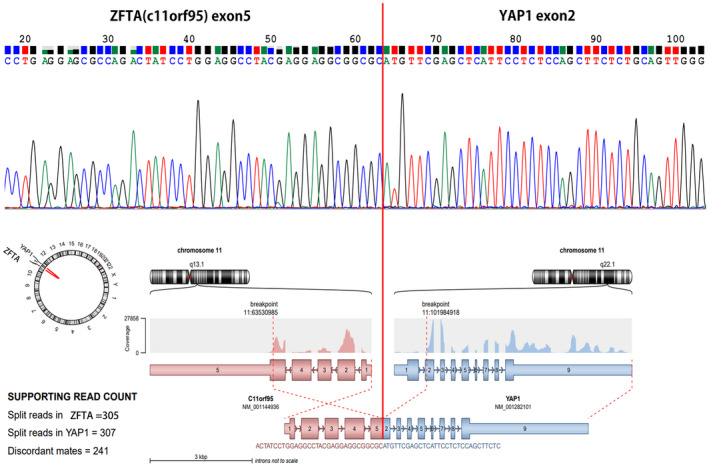 FIGURE 3