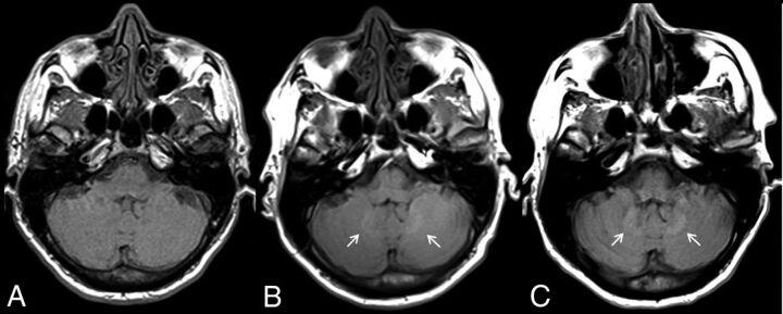 Fig 2.