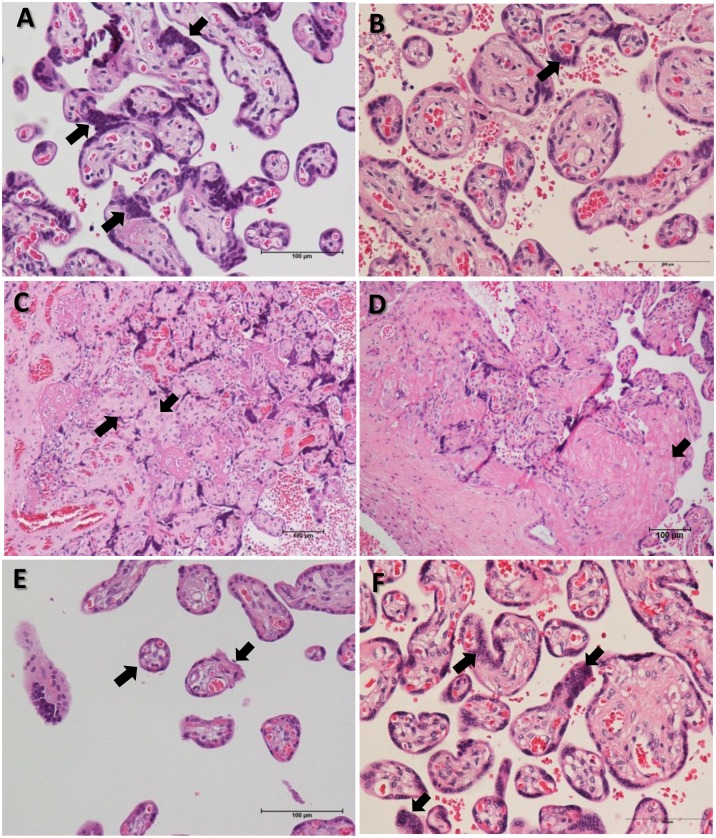 Fig 1