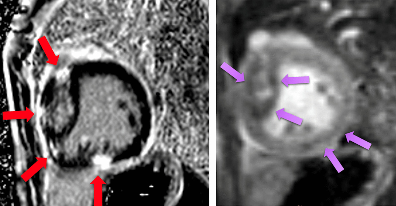 Fig. 23