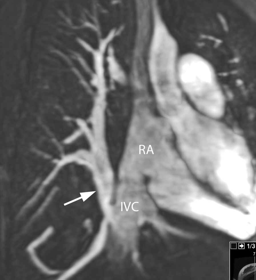 Fig. 16