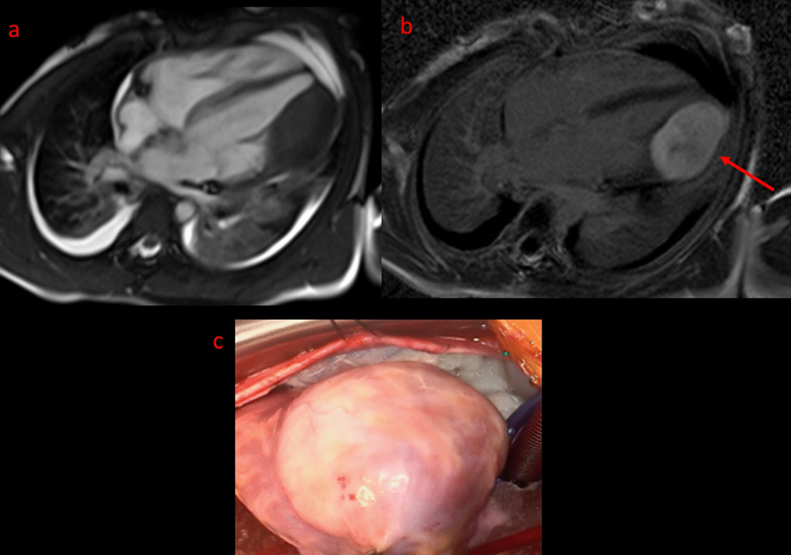 Fig. 45