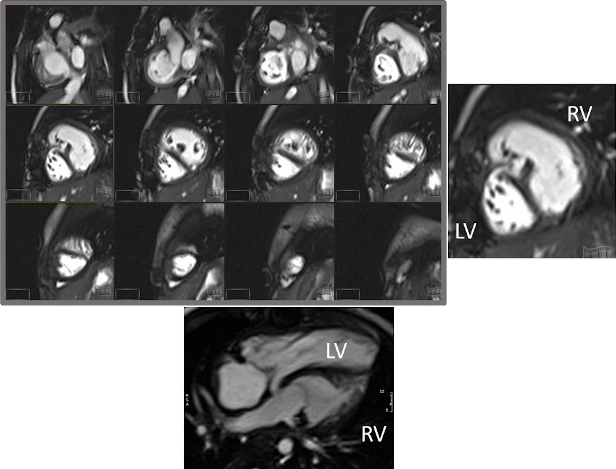 Fig. 41