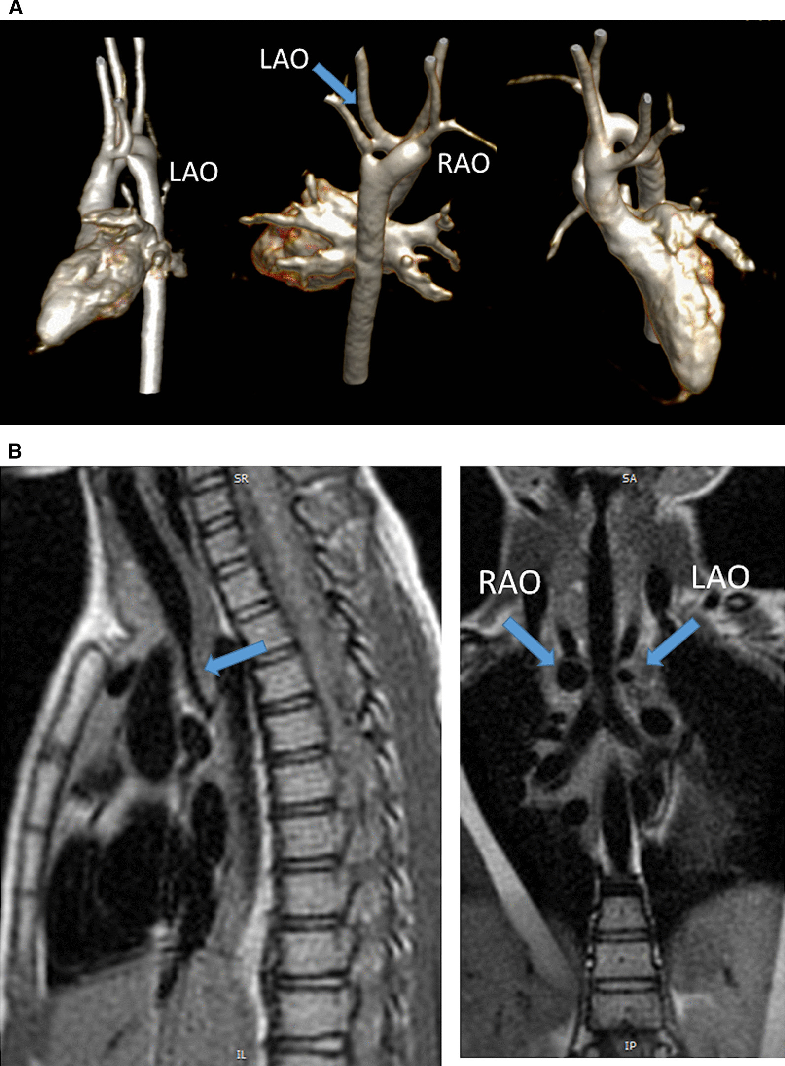 Fig. 35