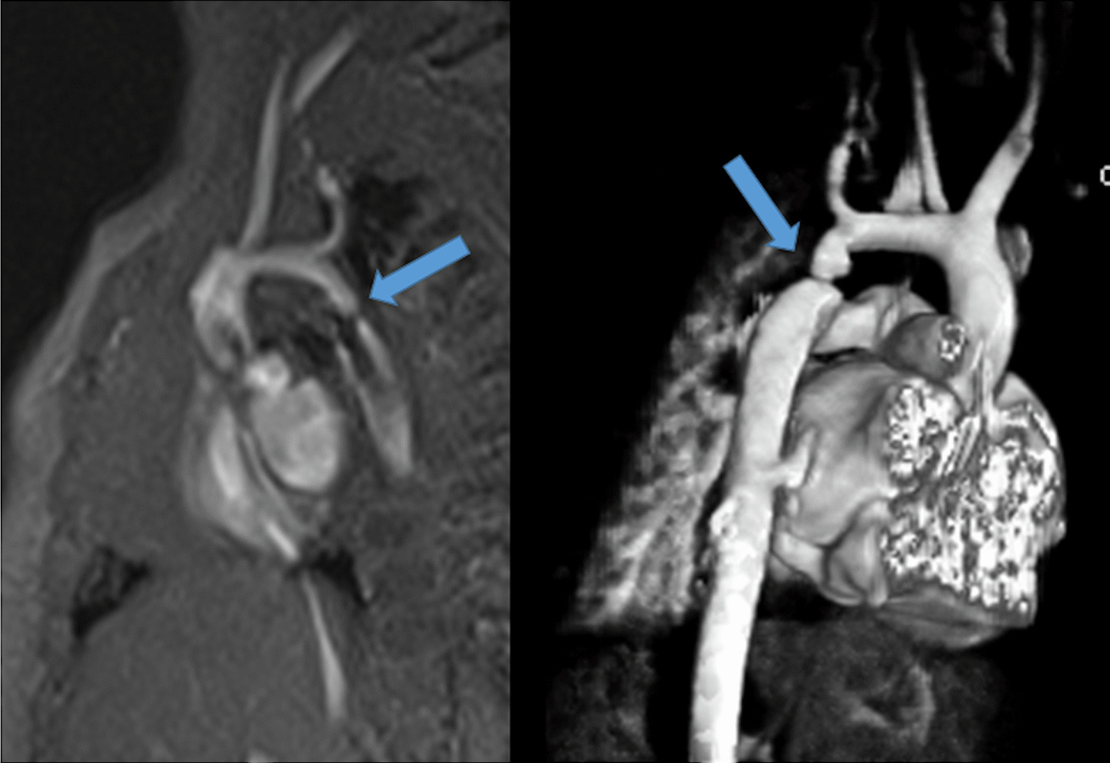 Fig. 25