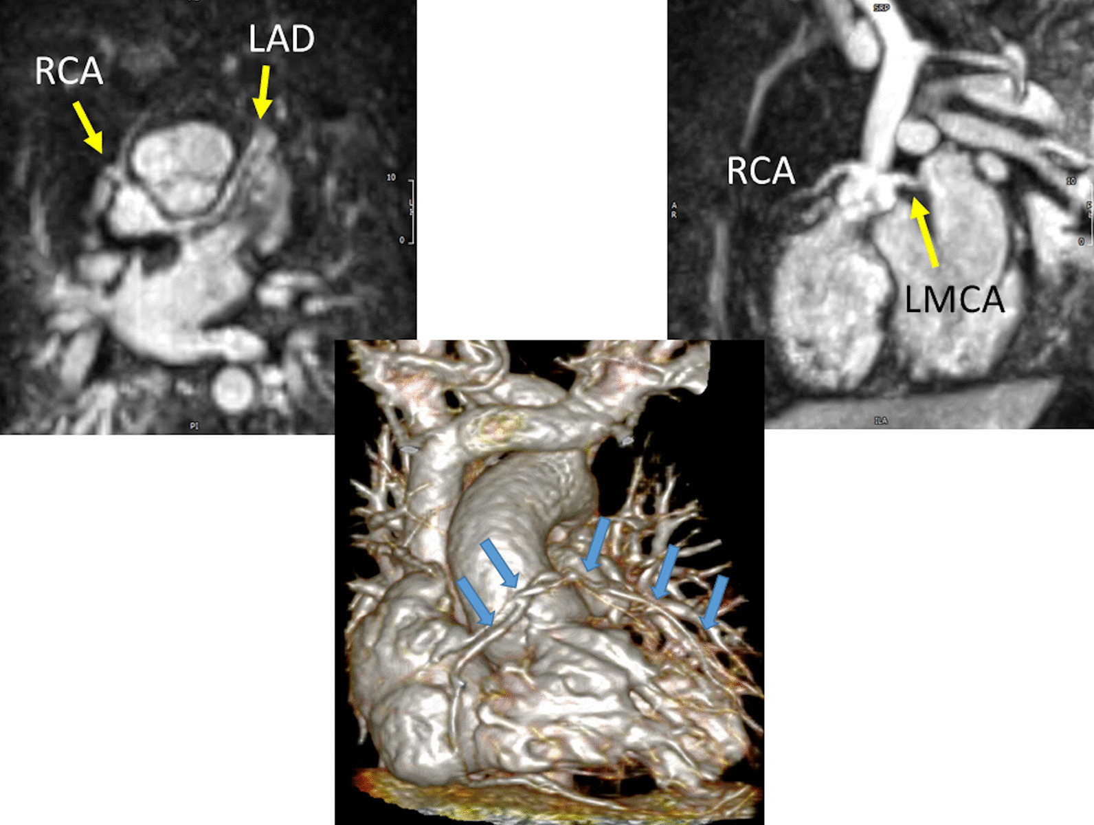 Fig. 20