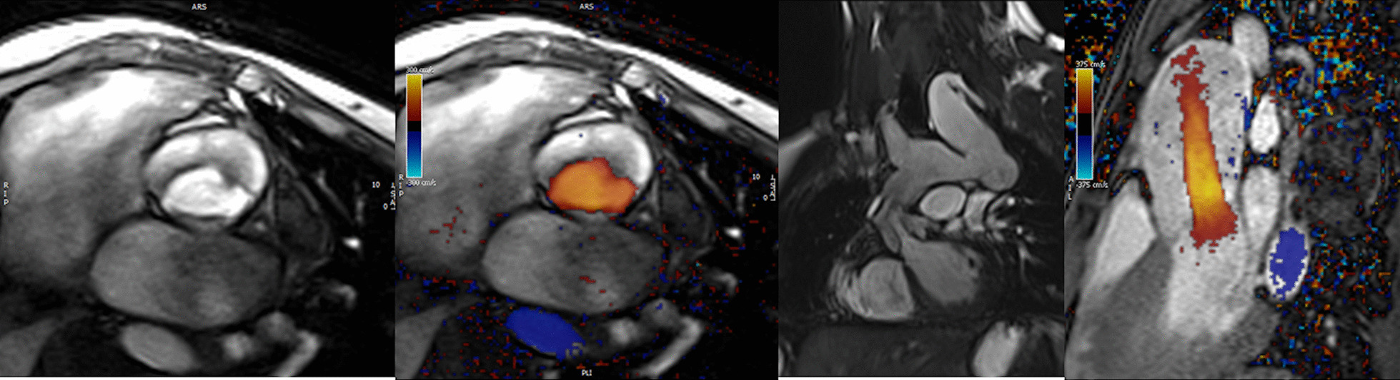 Fig. 30