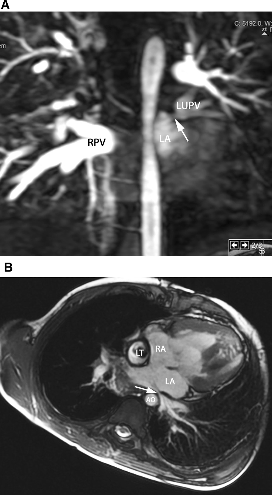 Fig. 19