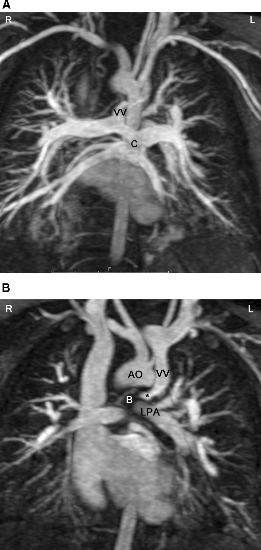 Fig. 17