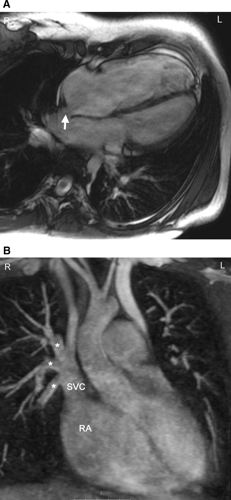 Fig. 15