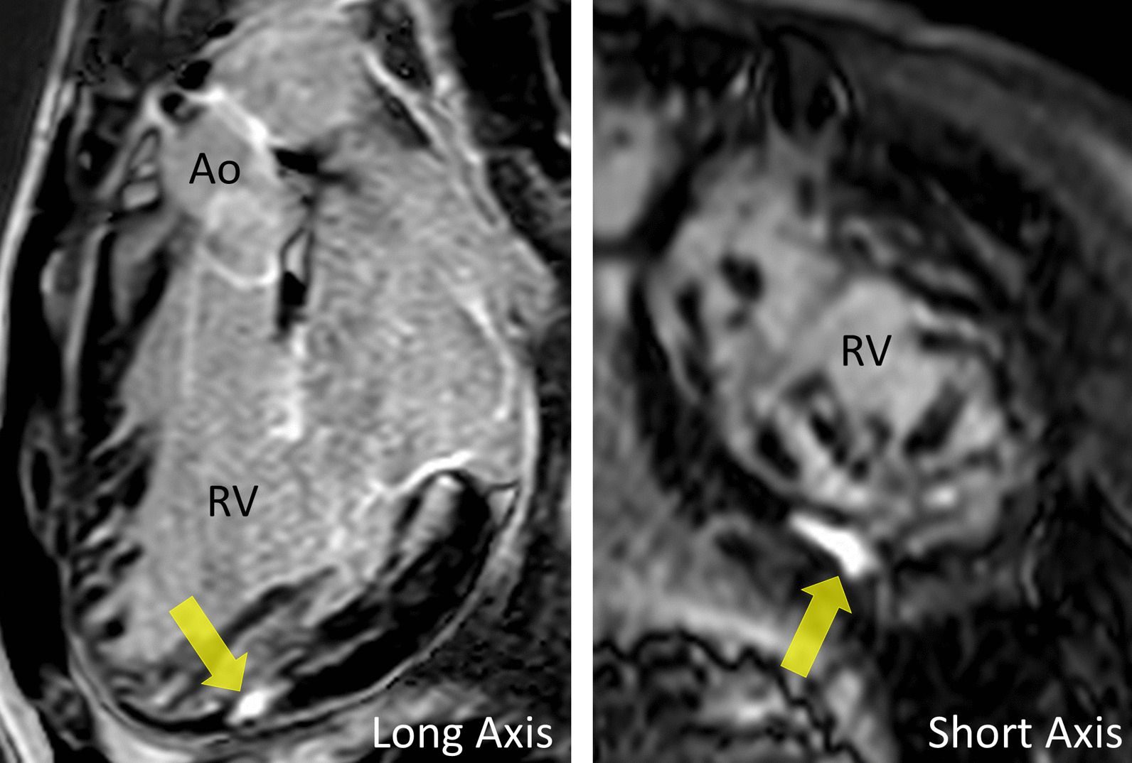 Fig. 42