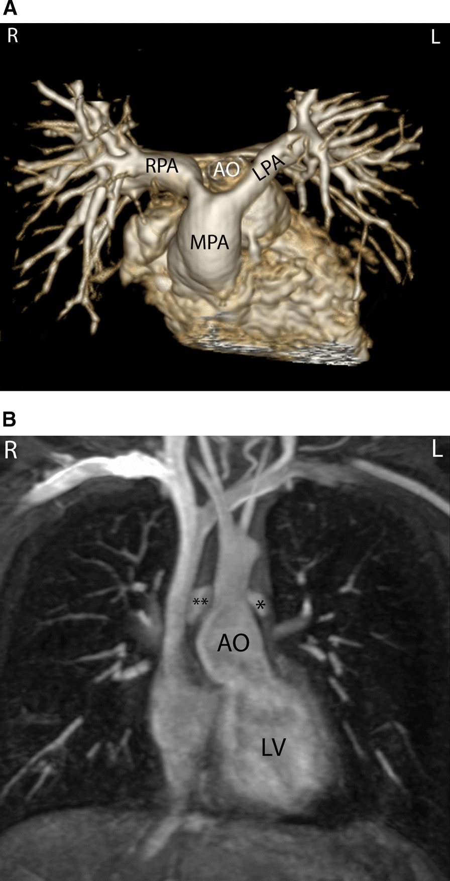 Fig. 12