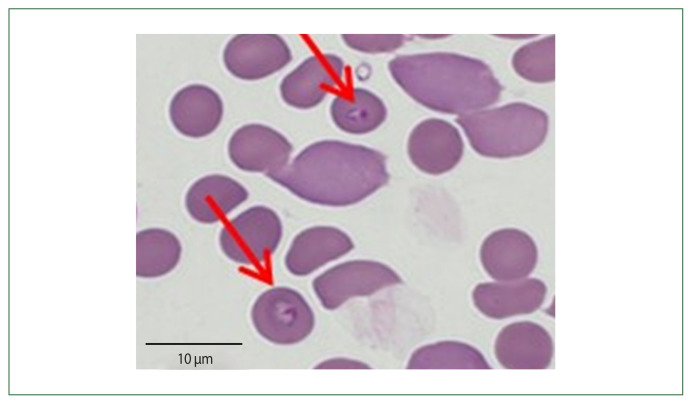 Fig. 2