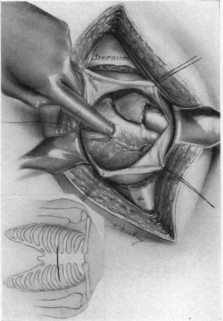 FIG. 10.